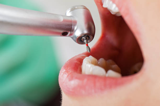 Best Emergency Treatment for Toothache in Augusta, ME